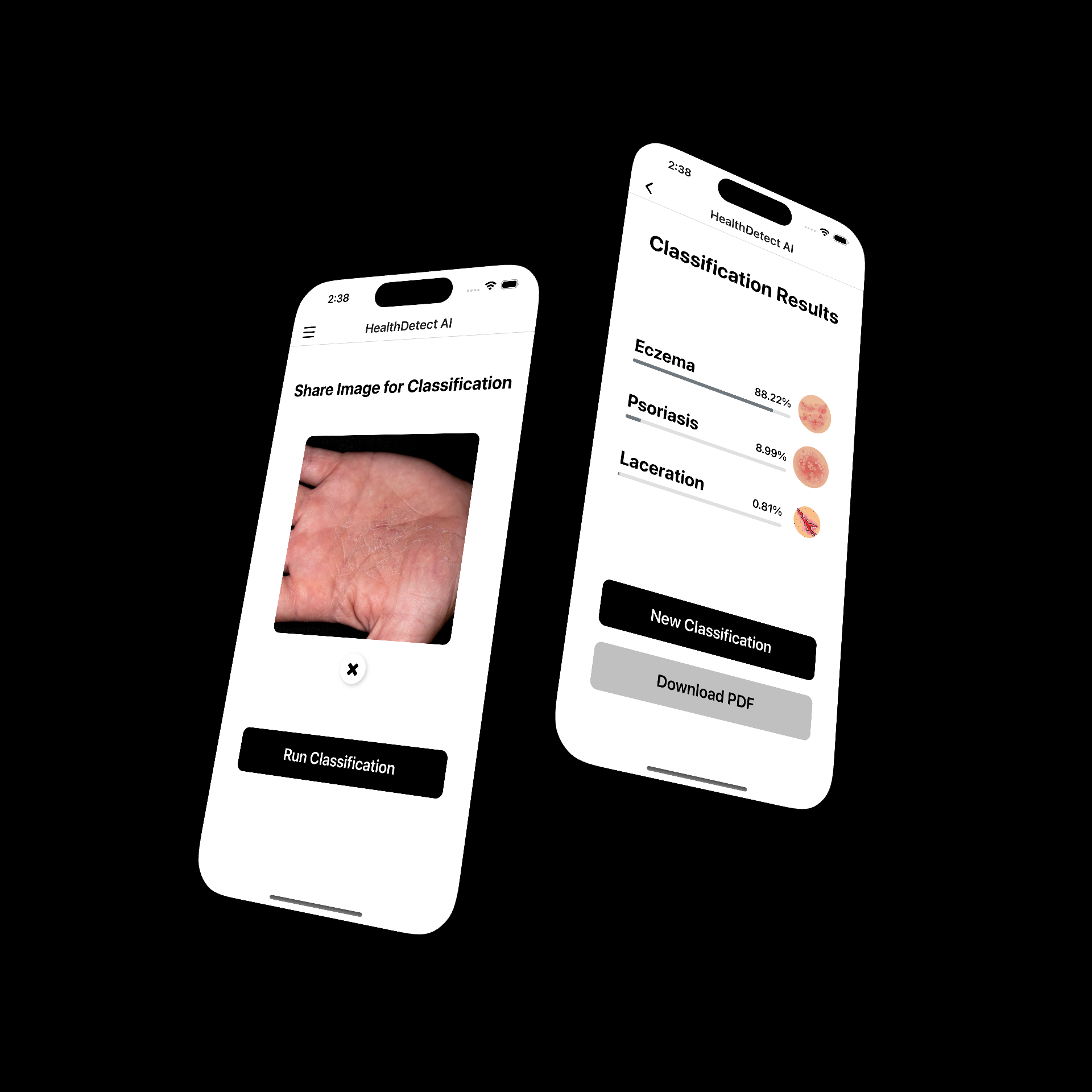 Health Detect AI